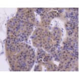 Anti-ATM Antibody from Bioworld Technology (BS9893M) - Antibodies.com