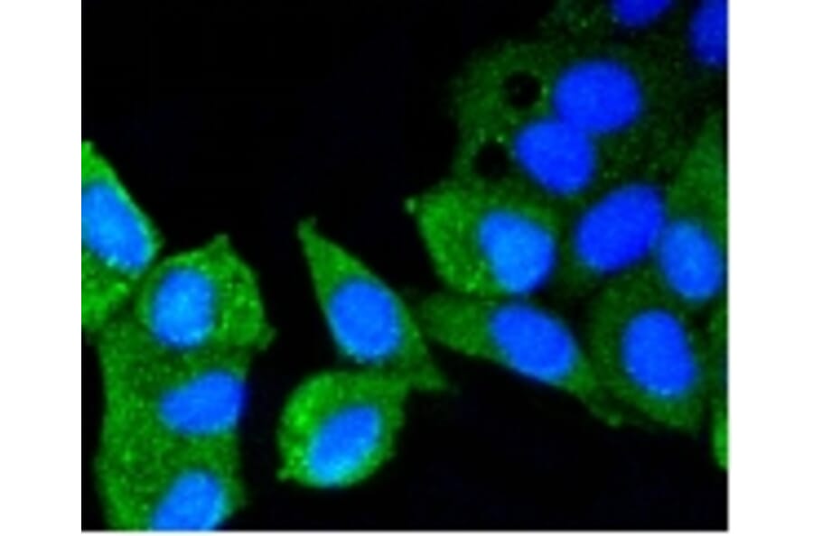 Anti-ATM Antibody from Bioworld Technology (BS9893M) - Antibodies.com