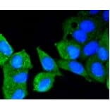 Anti-ATM Antibody from Bioworld Technology (BS9893M) - Antibodies.com
