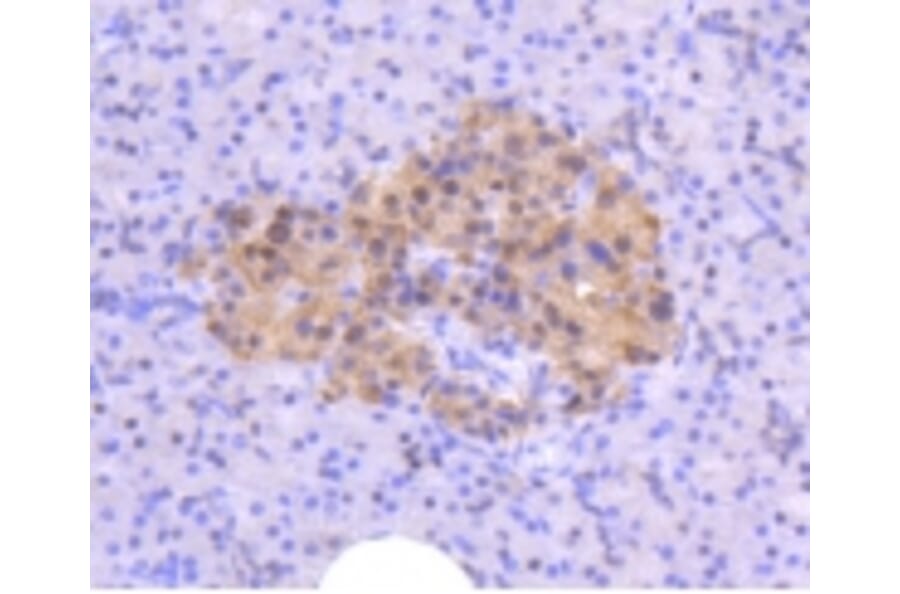 Anti-ATM Antibody from Bioworld Technology (BS9893M) - Antibodies.com