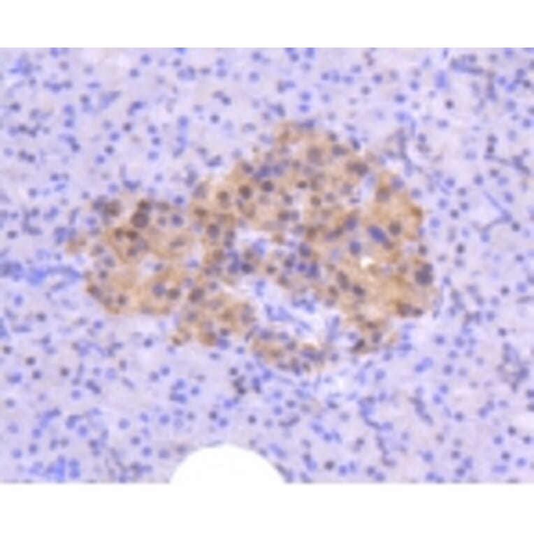Anti-ATM Antibody from Bioworld Technology (BS9893M) - Antibodies.com