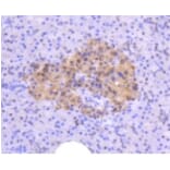 Anti-ATM Antibody from Bioworld Technology (BS9893M) - Antibodies.com