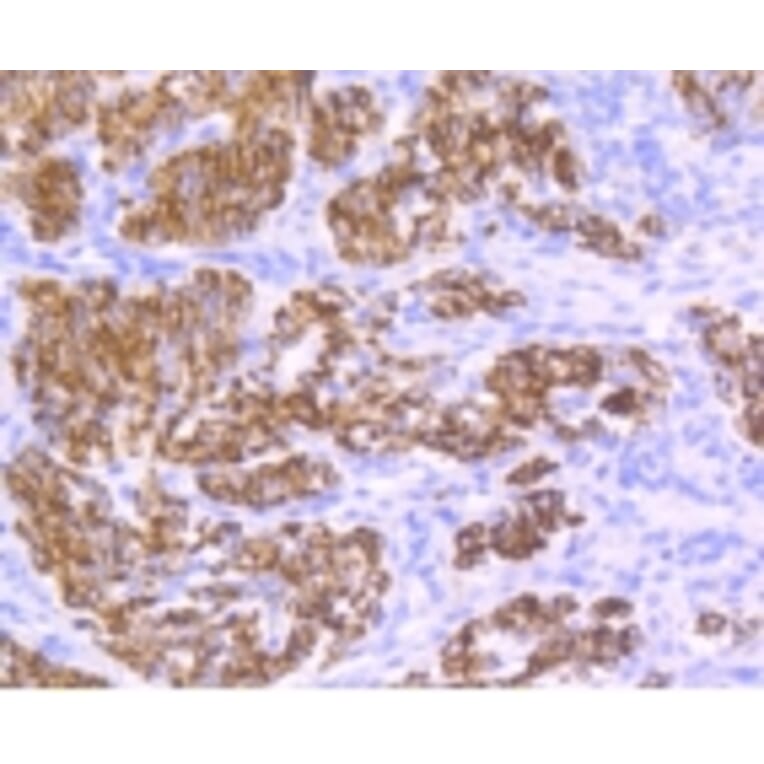 Anti-Desmin Antibody from Bioworld Technology (BS9895M) - Antibodies.com