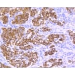 Anti-Desmin Antibody from Bioworld Technology (BS9895M) - Antibodies.com