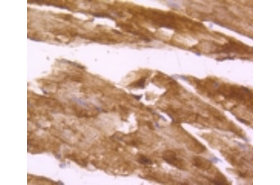 Anti-Desmin Antibody from Bioworld Technology (BS9895M) - Antibodies.com