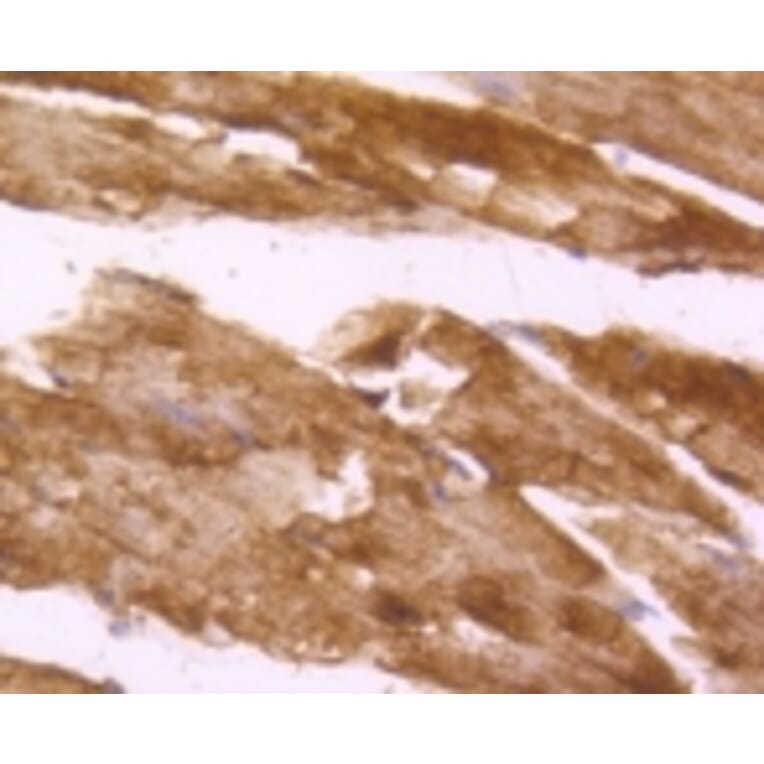 Anti-Desmin Antibody from Bioworld Technology (BS9895M) - Antibodies.com