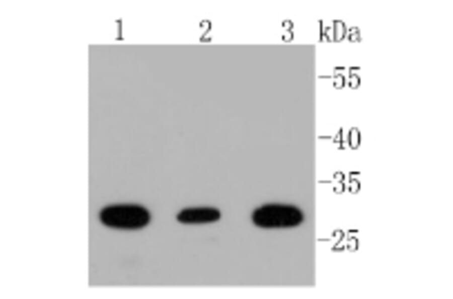 Anti-BDNF Antibody from Bioworld Technology (BS9896M) - Antibodies.com