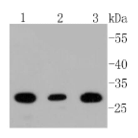 Anti-BDNF Antibody from Bioworld Technology (BS9896M) - Antibodies.com