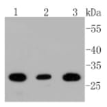 Anti-BDNF Antibody from Bioworld Technology (BS9896M) - Antibodies.com