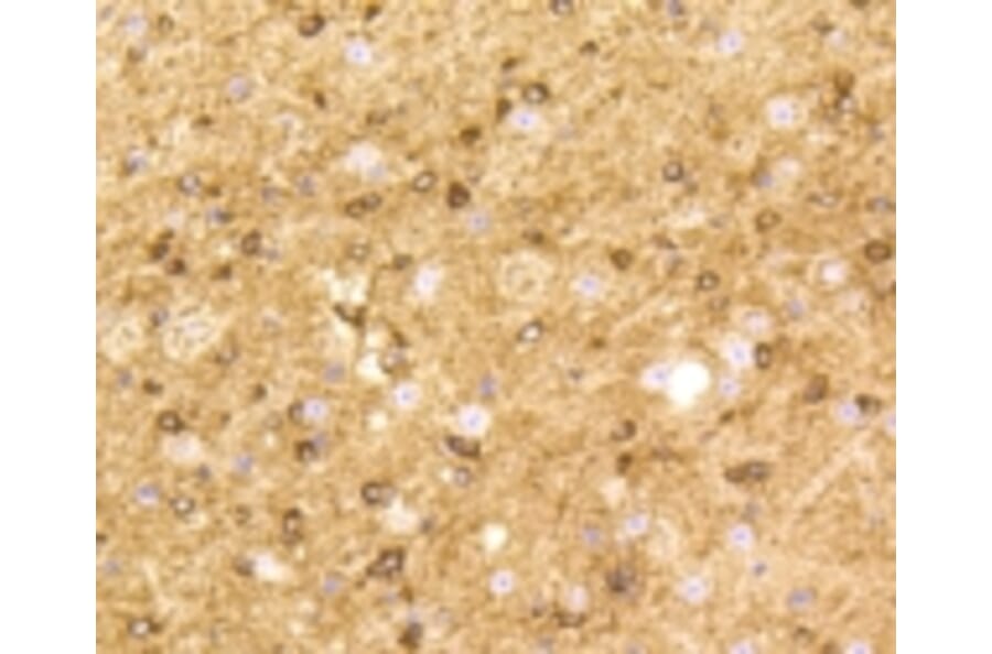 Anti-BDNF Antibody from Bioworld Technology (BS9896M) - Antibodies.com