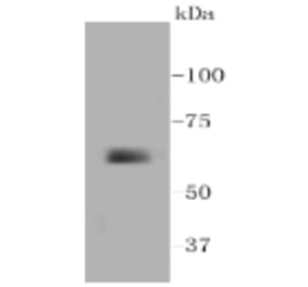 Anti-MMP14 Antibody from Bioworld Technology (BS9899M) - Antibodies.com