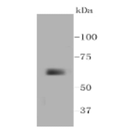 Anti-MMP14 Antibody from Bioworld Technology (BS9899M) - Antibodies.com