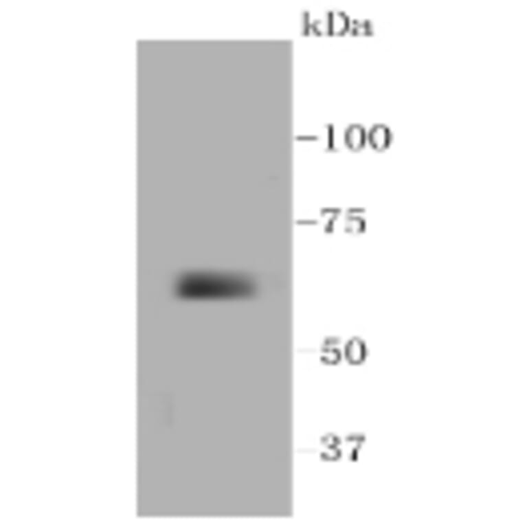 Anti-MMP14 Antibody from Bioworld Technology (BS9899M) - Antibodies.com