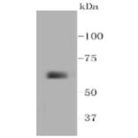 Anti-MMP14 Antibody from Bioworld Technology (BS9899M) - Antibodies.com