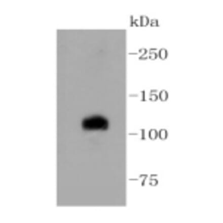 Anti-Notch 1 Antibody from Bioworld Technology (BS9902M) - Antibodies.com