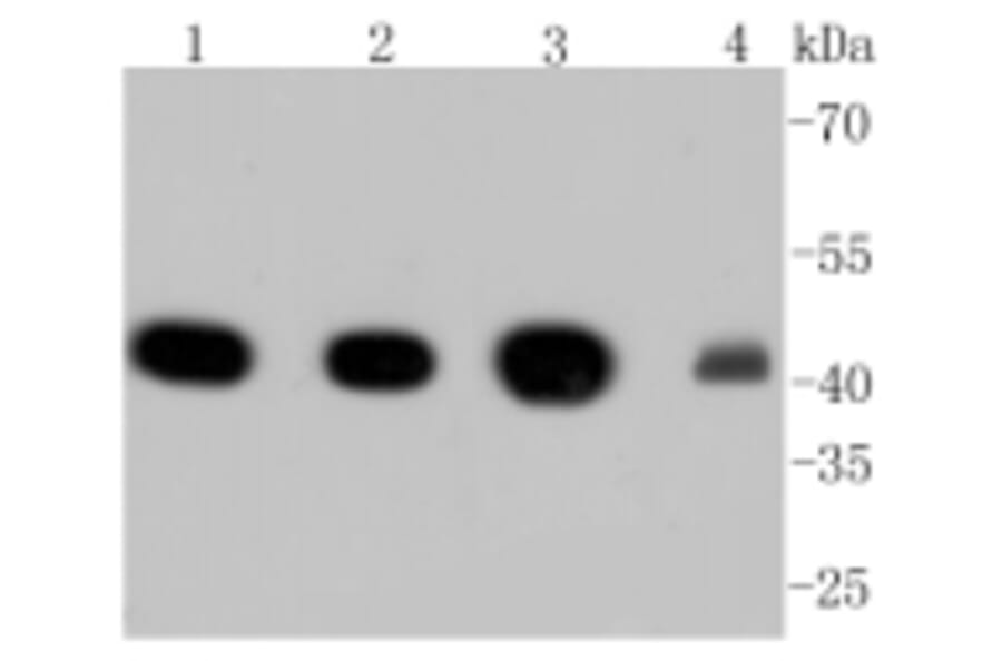 Anti-α-SMA Antibody from Bioworld Technology (BS9908M) - Antibodies.com