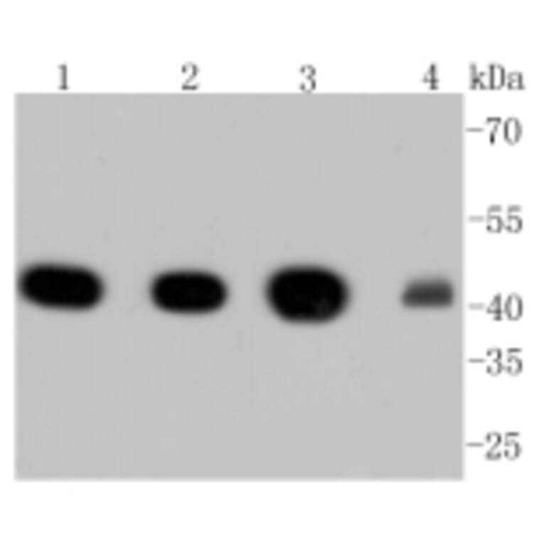 Anti-α-SMA Antibody from Bioworld Technology (BS9908M) - Antibodies.com