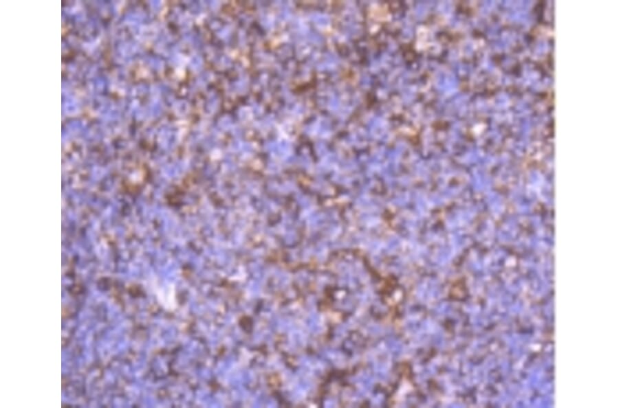 Anti-α-SMA Antibody from Bioworld Technology (BS9908M) - Antibodies.com