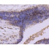 Anti-GSK3β Antibody from Bioworld Technology (BS9912M) - Antibodies.com