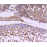 Anti-GSK3β Antibody from Bioworld Technology (BS9912M) - Antibodies.com