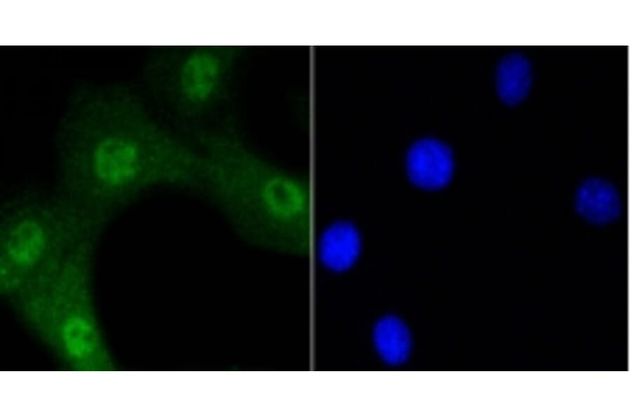 Anti-AKT (phospho-Ser473) Antibody from Bioworld Technology (BS9913M) - Antibodies.com