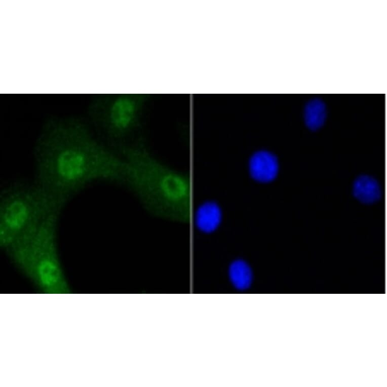 Anti-AKT (phospho-Ser473) Antibody from Bioworld Technology (BS9913M) - Antibodies.com
