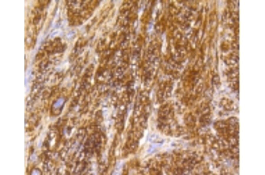 Anti-Caldesmon Antibody from Bioworld Technology (BS9915M) - Antibodies.com
