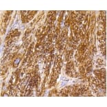 Anti-Caldesmon Antibody from Bioworld Technology (BS9915M) - Antibodies.com