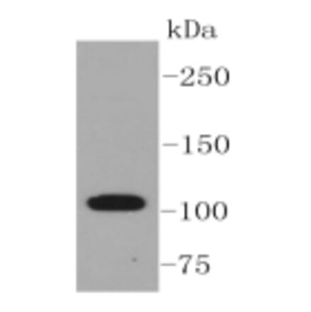 Anti-ABCG1 Antibody from Bioworld Technology (BS9916M) - Antibodies.com