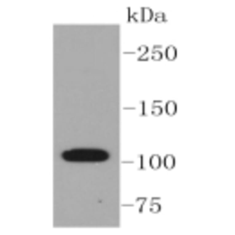 Anti-ABCG1 Antibody from Bioworld Technology (BS9916M) - Antibodies.com