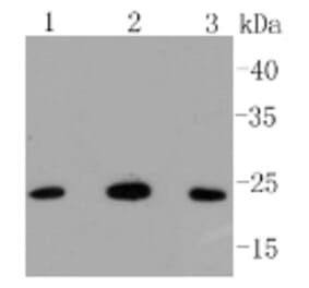 Anti-Bak Antibody from Bioworld Technology (BS9917M) - Antibodies.com
