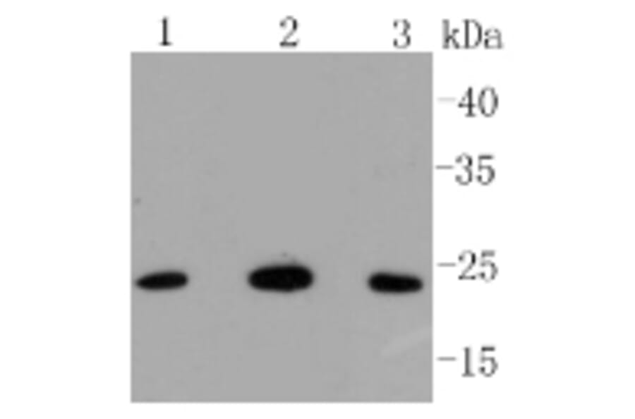 Anti-Bak Antibody from Bioworld Technology (BS9917M) - Antibodies.com