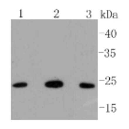 Anti-Bak Antibody from Bioworld Technology (BS9917M) - Antibodies.com