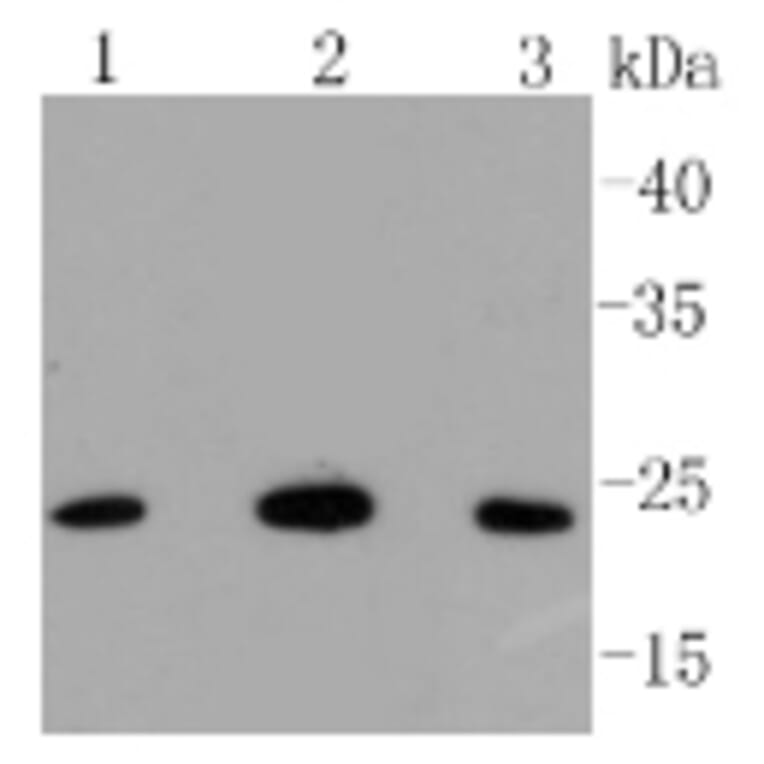 Anti-Bak Antibody from Bioworld Technology (BS9917M) - Antibodies.com