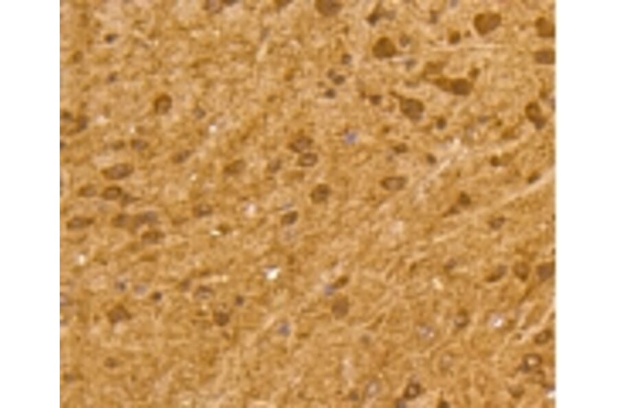 Anti-Ubiquitin Antibody from Bioworld Technology (BS9922M) - Antibodies.com