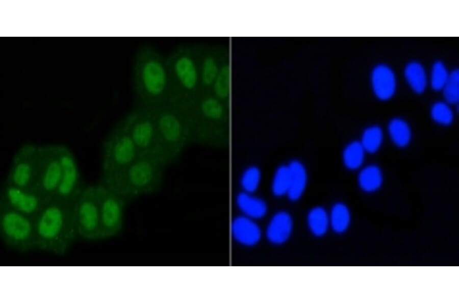 Anti-ASH2L Antibody from Bioworld Technology (BS9923M) - Antibodies.com