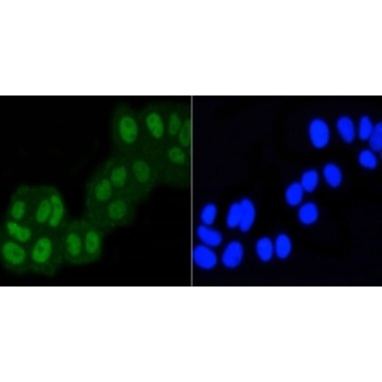 Anti-ASH2L Antibody from Bioworld Technology (BS9923M) - Antibodies.com