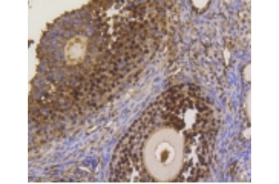 Anti-ASH2L Antibody from Bioworld Technology (BS9923M) - Antibodies.com