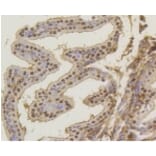 Anti-ASH2L Antibody from Bioworld Technology (BS9923M) - Antibodies.com