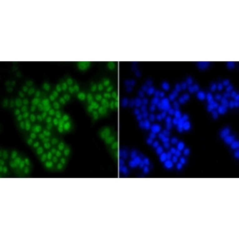 Anti-ASH2L Antibody from Bioworld Technology (BS9923M) - Antibodies.com