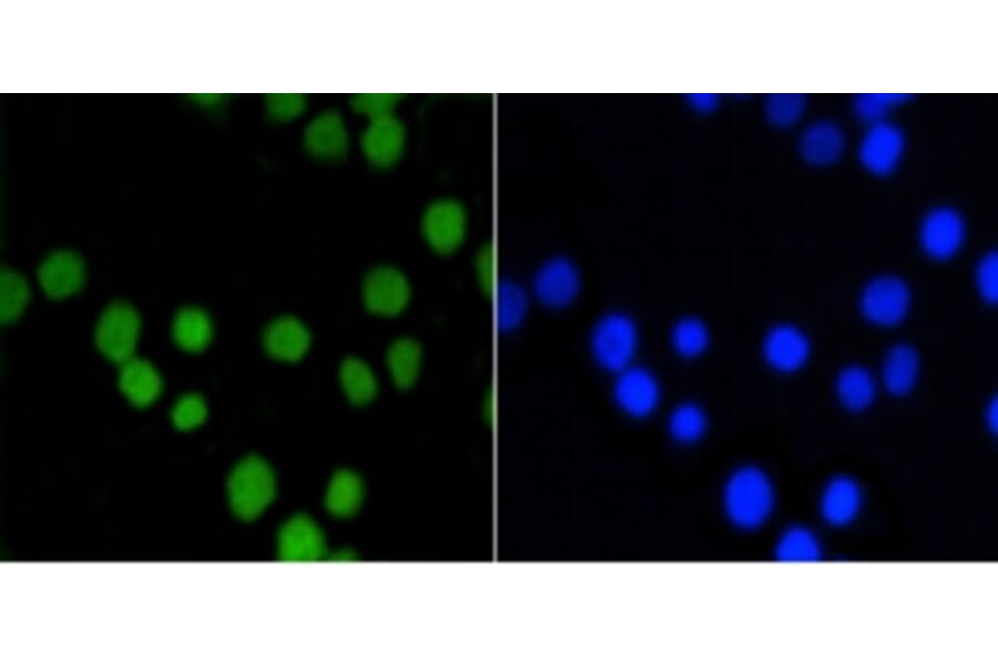 Anti-ASH2L Antibody from Bioworld Technology (BS9923M) - Antibodies.com