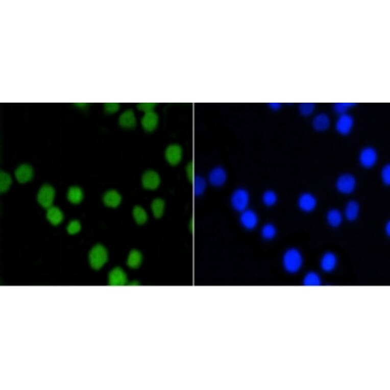 Anti-ASH2L Antibody from Bioworld Technology (BS9923M) - Antibodies.com