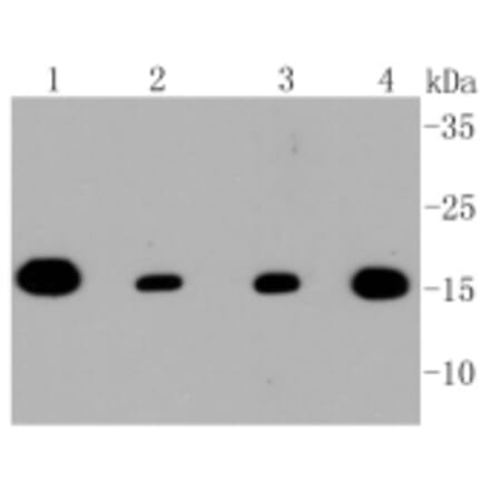 Anti-TOMM20 Antibody from Bioworld Technology (BS9924M) - Antibodies.com