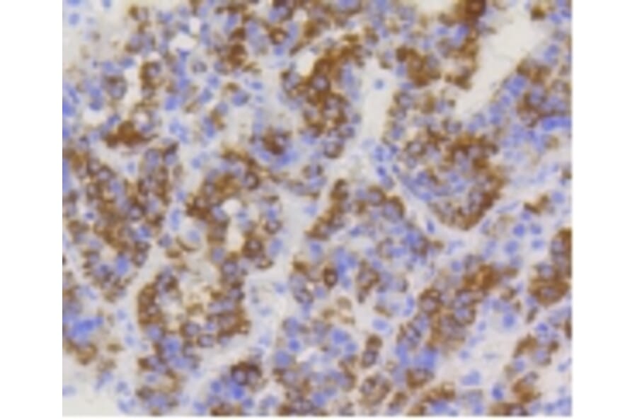 Anti-TOMM20 Antibody from Bioworld Technology (BS9924M) - Antibodies.com