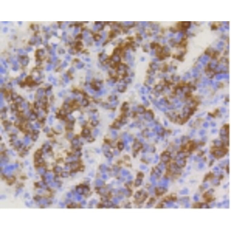 Anti-TOMM20 Antibody from Bioworld Technology (BS9924M) - Antibodies.com