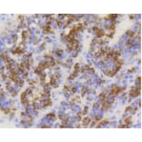 Anti-TOMM20 Antibody from Bioworld Technology (BS9924M) - Antibodies.com