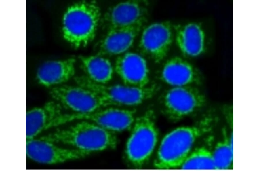 Anti-TOMM20 Antibody from Bioworld Technology (BS9924M) - Antibodies.com