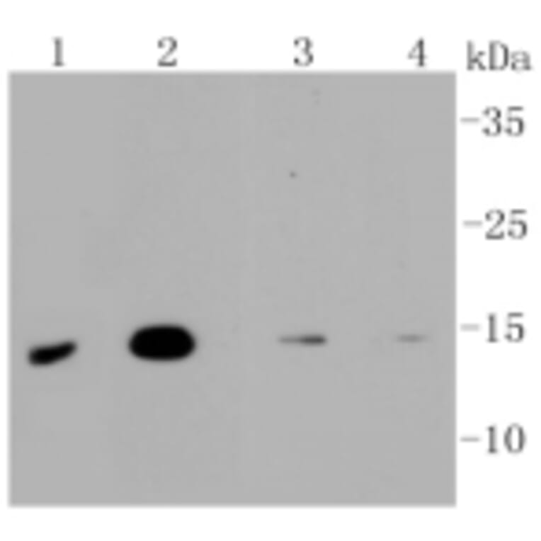 Anti-MAP1LC3A Antibody from Bioworld Technology (BS9925M) - Antibodies.com