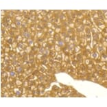 Anti-MAP1LC3A Antibody from Bioworld Technology (BS9925M) - Antibodies.com