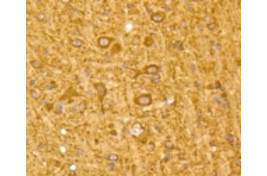 Anti-MAP1LC3A Antibody from Bioworld Technology (BS9925M) - Antibodies.com